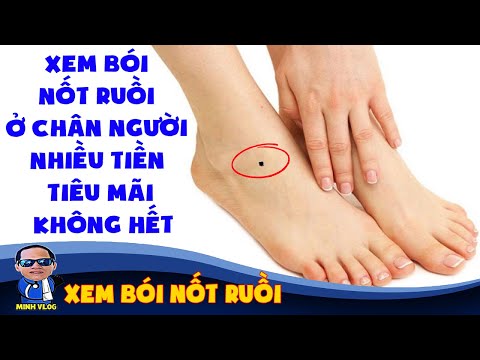 Xem bói nốt ruồi ở chân người nhiều tiền tiêu mãi không hết | Xem bói nốt ruồi