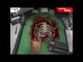 Surgeon Simulator 2013 - Let's Play Chirurgie-Simulator mit Doktor Obermeier