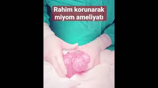 Miyom Ameliyatı Uterine Fibroid Surgery 90 530 833 7940