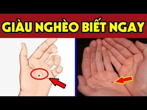 Nếu Có 5 Nốt Ruồi Này Trong Lòng Bàn Tay Trời Định Sẵn Bạn Có Số GIÀU SANG PHÚ QUÝ Tiền Chất Đầy Nhà