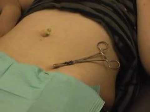 Jordy's Surface Piercings. 06:13 Mins | Visto 116134 veces Jordy's Surface Piercings. 06:13 Mins | Visto 116134 veces