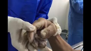 Otopsi Sırasında Neler Yaşanır? Bilmeniz Gereken 5 Kritik Aşama