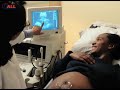Baby Steps: 4D Ultrasound