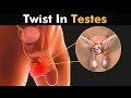 What Happens in Testicular Torsion? | Symptoms, Causes And Treatment (Urdu/Hindi)