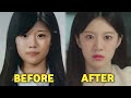 Sering Dipuji Cantik, 12 Aktris Korea ini Ternyata Operasi Plastik