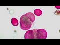 Little Science Behind 'pollen Vortex' Prediction