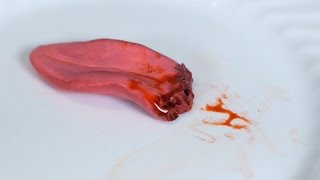 Tongue Bitten Off