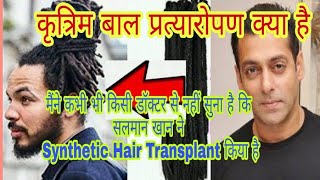 What is Synthetic Hair Transplant Complete Information