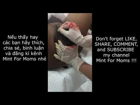 Sinh thường - Cao trào 1 trường hợp sinh con đầy cảm động với sự giúp đỡ cô nữ hộ sinh ngọt ngào.