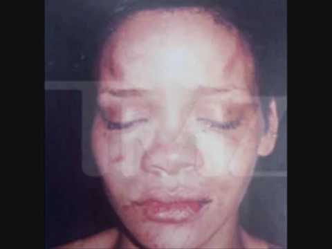 rihanna pictures chris brown beating. CNN:Why did Chris Brown Beat
