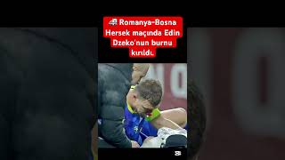 Romanya-Bosna Hersek Maçında Edin Dzekonun Burnu Kırıldı.