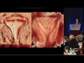 Ultrasound First and Imaging of the Pelvis - Beryl Benacerraf, MD