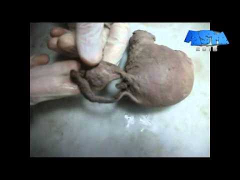 Anatomy of Uterus, Fallopian tube & Ovary by ASM - YouTube