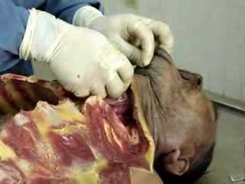 WWW YOUTUBE COM VIDEO DE AUTOPSIA www youtube com video de autopsia: