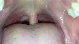 Giantess Mouth Tour