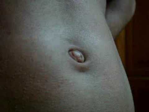 This shows a belly button that can be both, an inny and an outie belly 