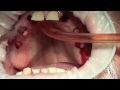 cirugía dental