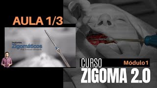 AULA 1 de 3 - Curso Zigoma 2.0 - Introdução aos Implantes Zigomáticos