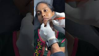 Mole Tattoo 9848312719