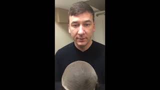 DIY Hair Replacement