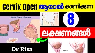 Cervix Open Symptoms Malayalamcervix Open Signs