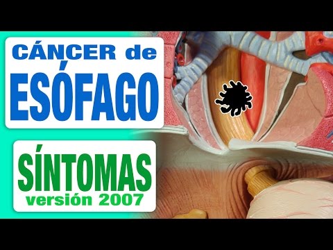 El alcoholismo los documentales