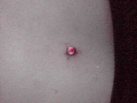 MICRODERMAL GALLERY. Category:People & Blogs Length:00:00:27.500 MICRODERMAL GALLERY. Category:People & Blogs Length:00:00:27.500