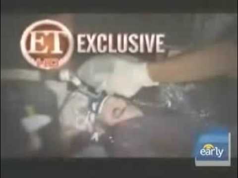 princess diana death photos and michael jackson autopsy picture. Autopsy Set After Michael