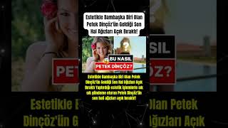 Estetikle Bambaşka Biri Olan Petek Dinçözün Geldiği Son Hal Ağızları Açık Bıraktı
