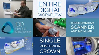 Entire Digital Workflow For Cerec Omnicam Scanner And Mc Xl Mill For A Single Posterior Crown
