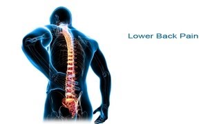 5 Steps To Lower Back Pain Relief