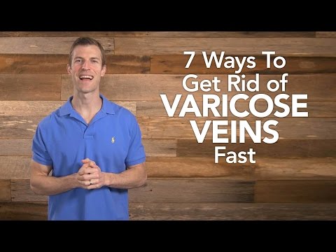 7 Ways to Get Rid of Varicose Veins Fast | Dr. Josh Axe