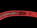 micro catheter