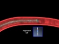 micro catheter