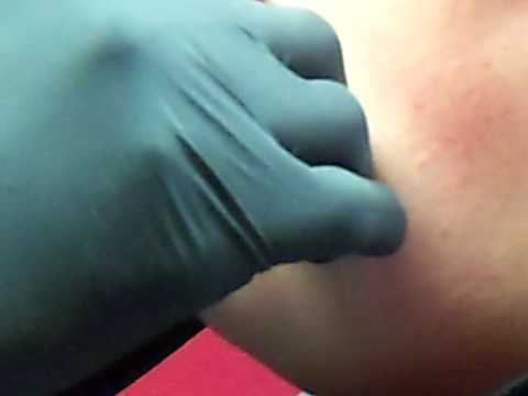 Me getting my Lip pierced!