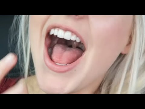 Mouth open compilation