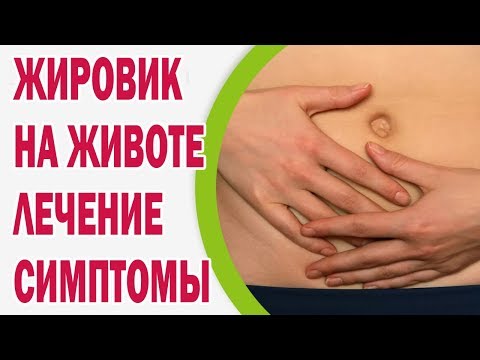 Вылечить живот в домашних условиях 666 Вылечить живот в домашних условиях 915