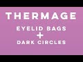 Thermage Eyes - Dr. Nissan Pilest (Irvine, CA)