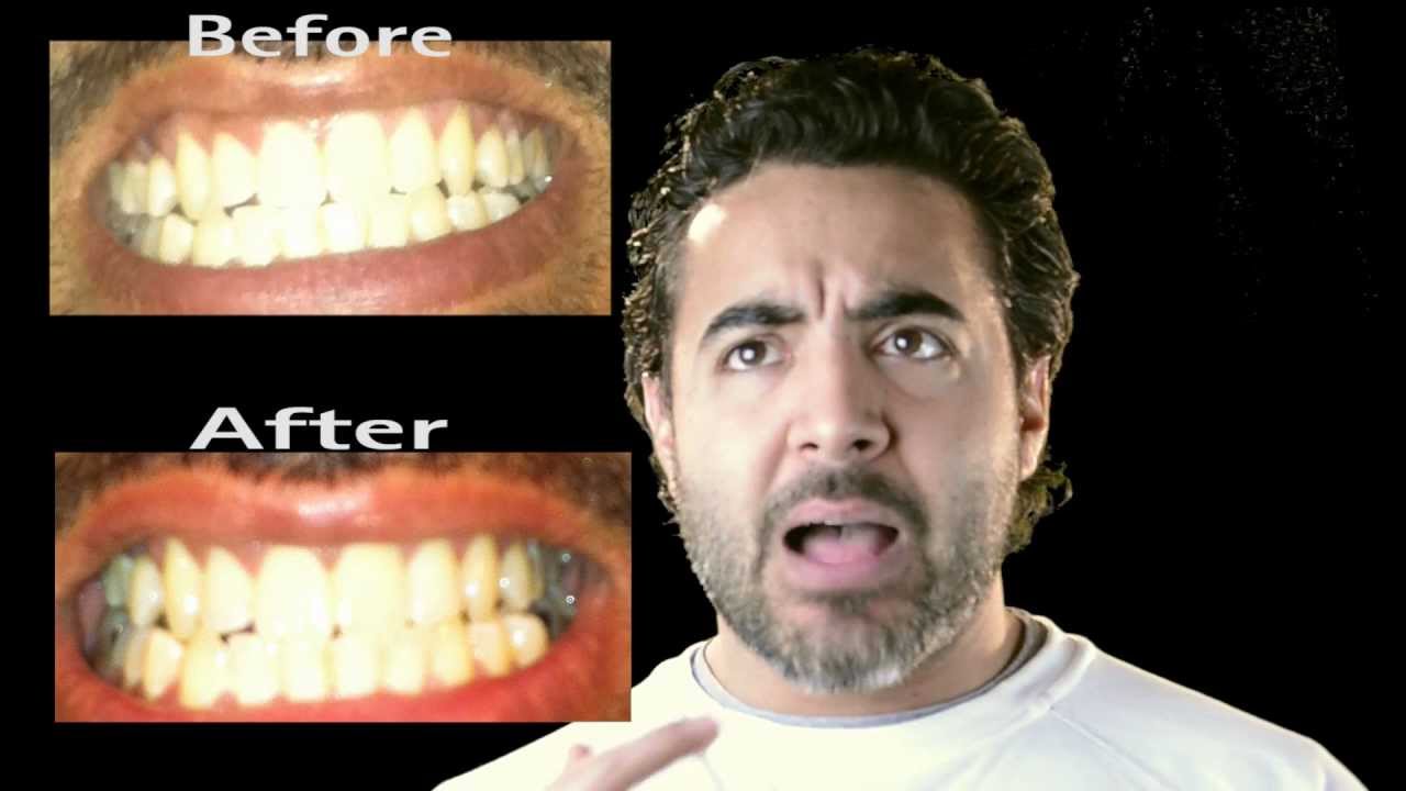 Banana peel to whiten your teeth- does it work-review - YouTube