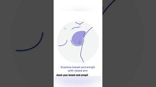 Breast Self-Exam