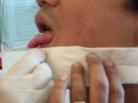 Piercings laterales de lengua