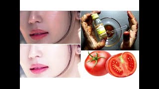 1 ही दिन में चेहरे को इतना गोरा बना देगा ये नुस्खा / Get Fair, Glowing, Spotless Skin Permanently
