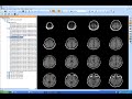 MicroDicom - Free DICOM Viewer