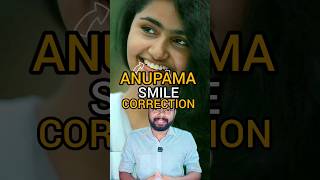 Anupama Parameswaran Smile Correction