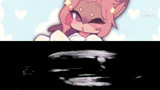 Typh Evolution