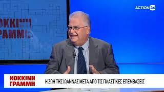 Θεραπείες Χημικών Εγκαυμάτων Στο Πρόσωπο Από Βιτριόλι - Dr. Med. Βασίλης Παυλιδέλης