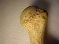 Humerus Structure | RM. Humerus Structure | RM.