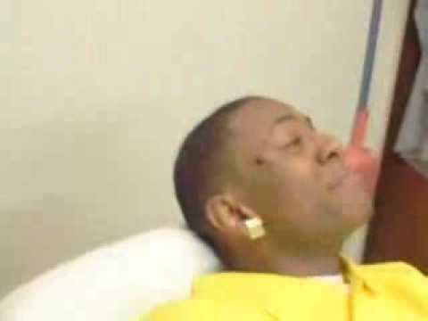 Soulja Boy Got A Hella Pimple On His Face! "Size Of A Nipple"