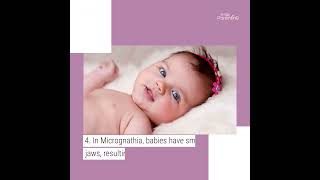 Does Your Baby Stick Their Tongue Out? Check Out The Reasons