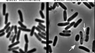 E. Coli Hides Armor In Plain Sight